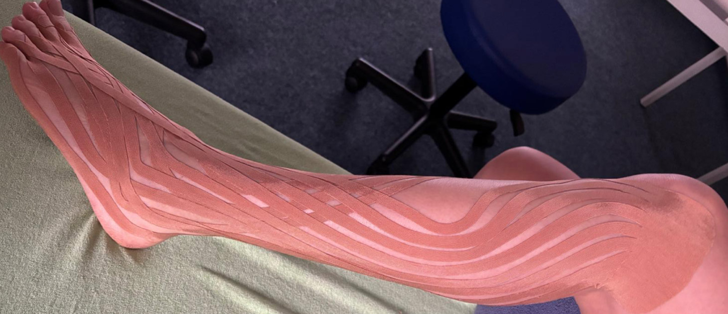 Ein Bein unterhalb des Knies mit Lymph-Taping